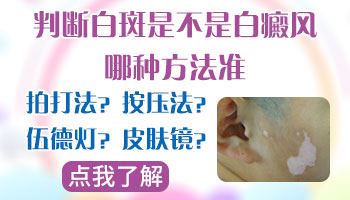 泛发型白癜风的常见危害有哪些?